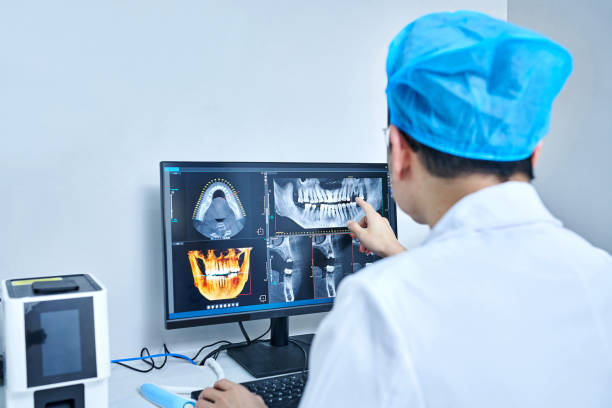 Best Emergency Tooth Extraction in Pascagoula, MS